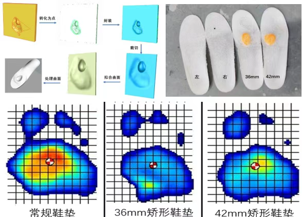 瑞金骨科研究所如何利用 3D Systems 增材制造解決方案構(gòu)建個性化矯形器和導(dǎo)板的工作流程